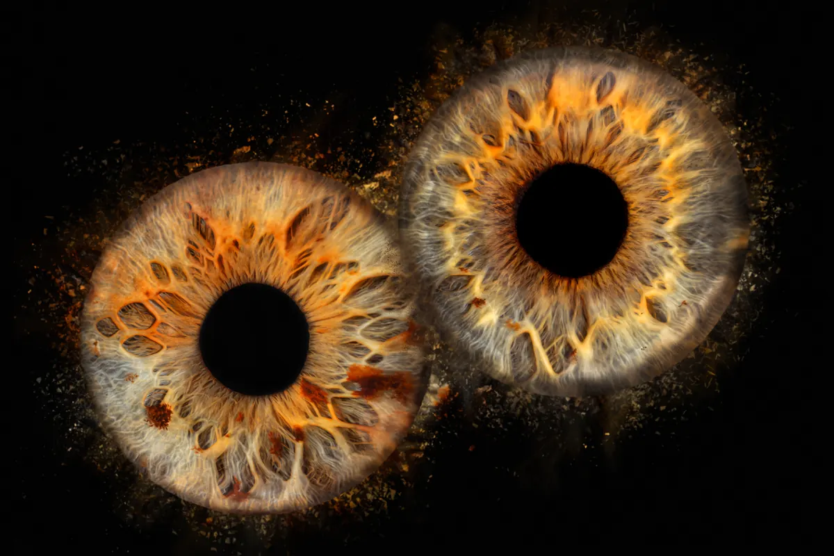 Iris
